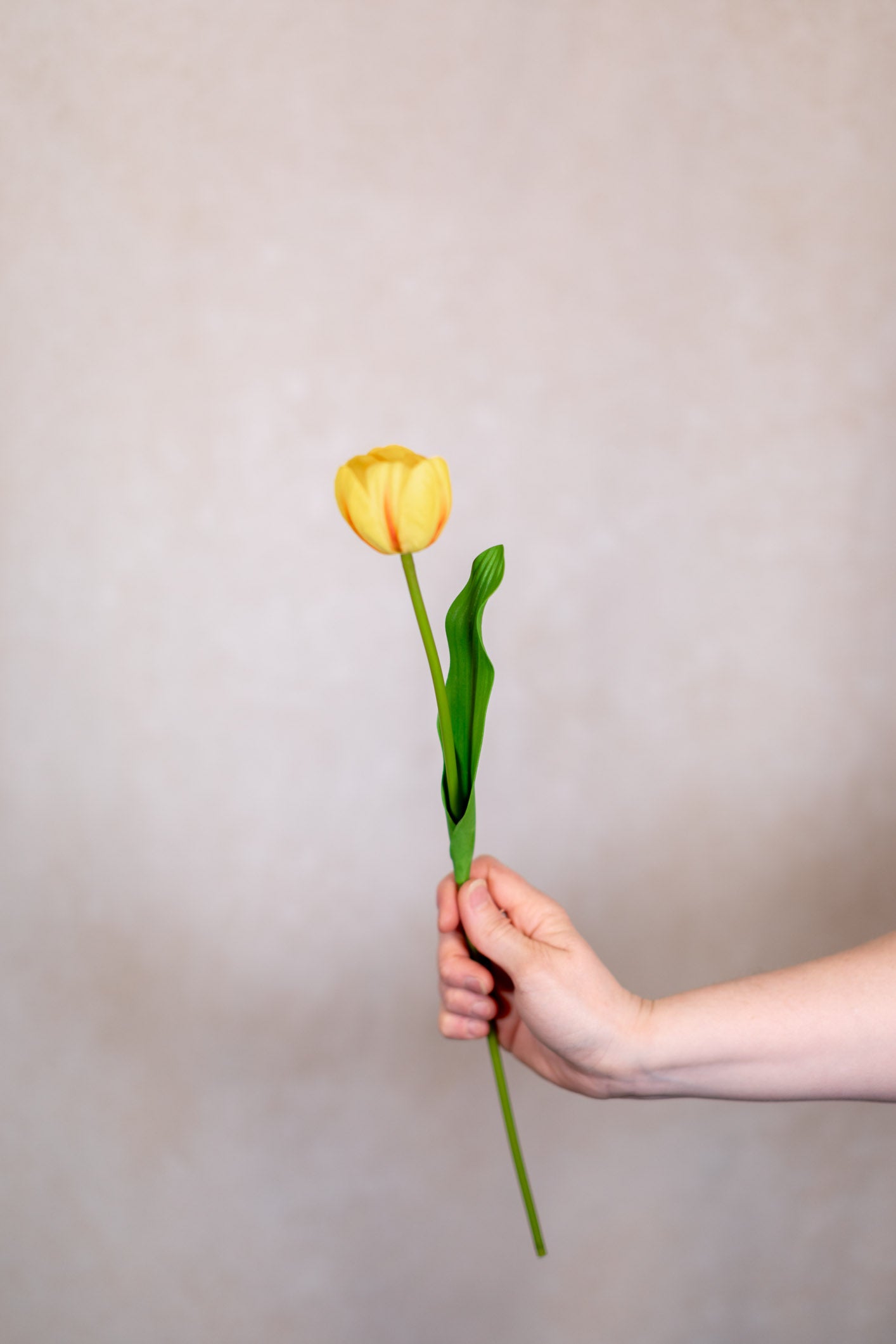 Tulip Bundle of Six Yellow Cerise